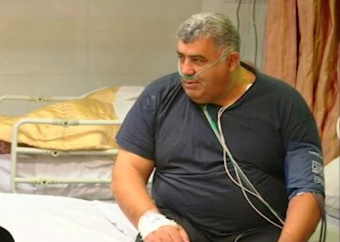 بیماری رضا سوخته سرایی - مگاورزش بیماری رضا سوخته سرایی