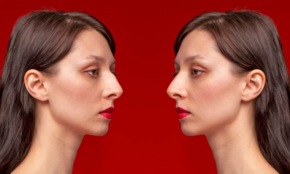 بینی طبیعی و بدون عمل در سال ۲۰۲۶